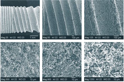  Osteoinduktives Material:  Revolutionieren Sie Ihre Implantate mit Hydroxyapatit!